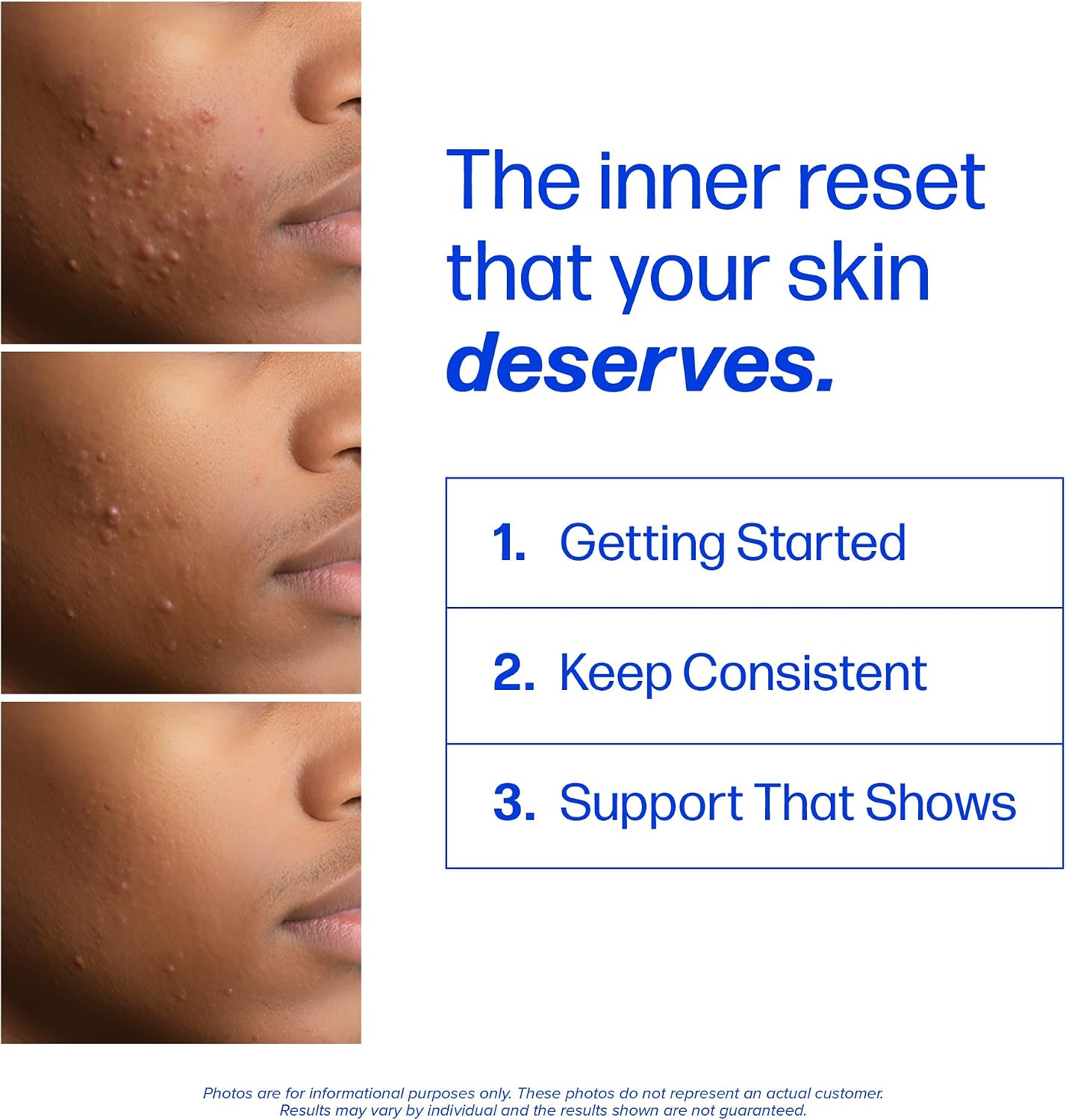 NIVIO™ Triple Action Clear 3, 120 Capsules